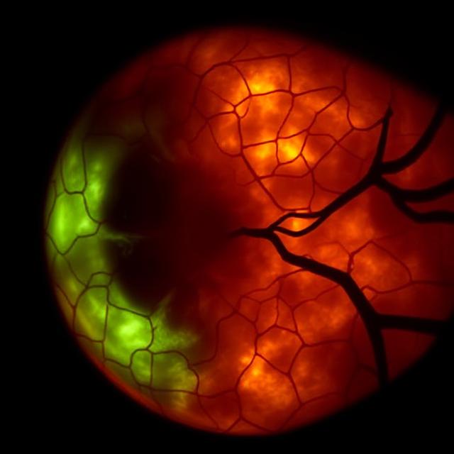 Mitochondrial Dysfunction in the Aging Retina