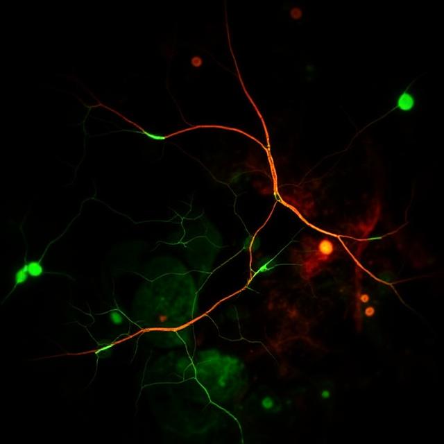 Photobiomodulation Mediates Neuroprotection against Blue Light Induced Retinal Photoreceptor Degeneration