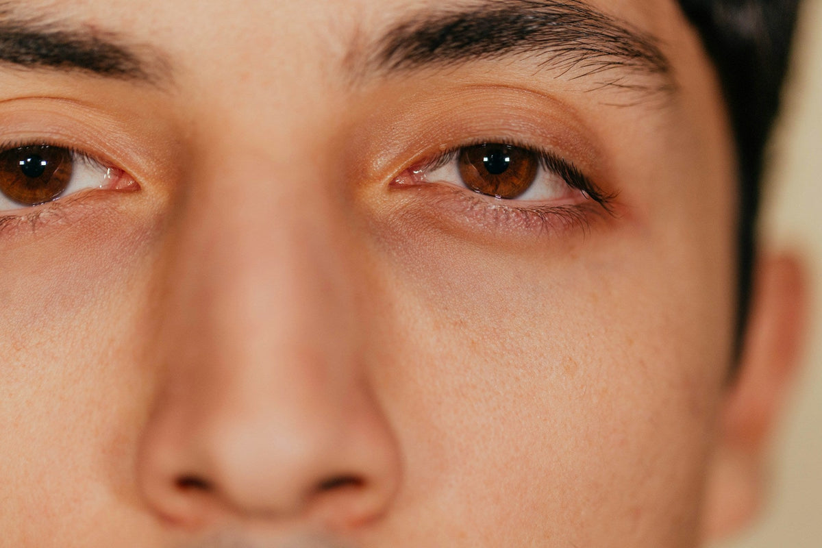 dry eyes
